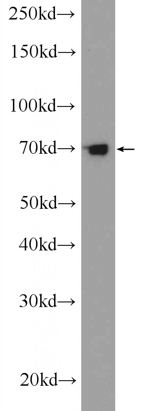 Y79 cells were subjected to SDS PAGE followed by western blot with Catalog No:115076(SEC14L1 Antibody) at dilution of 1:300