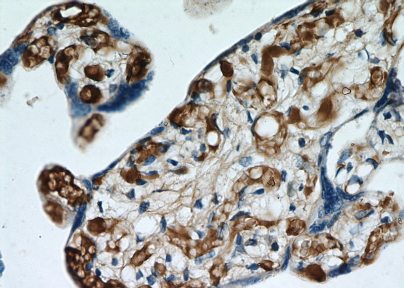 Immunohistochemical of paraffin-embedded human placenta using Catalog No:114181(PZP antibody) at dilution of 1:50 (under 40x lens)
