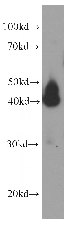 HEK-293 cells were subjected to SDS PAGE followed by western blot with Catalog No:107527(SERPINE2 Antibody) at dilution of 1:2000