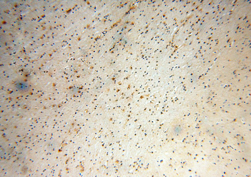 Immunohistochemical of paraffin-embedded human brain using Catalog No:114962(S100A5 antibody) at dilution of 1:100 (under 10x lens)