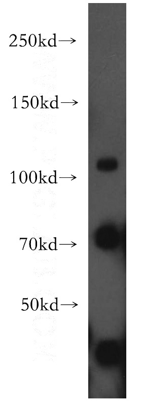 mouse brain tissue were subjected to SDS PAGE followed by western blot with Catalog No:110342(RAPGEF4 antibody) at dilution of 1:200