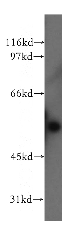 PC-3 cells were subjected to SDS PAGE followed by western blot with Catalog No:110780(FSCN3 antibody) at dilution of 1:800