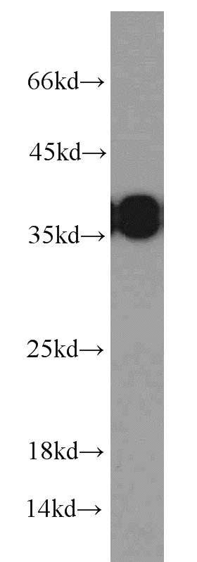 HeLa cells were subjected to SDS PAGE followed by western blot with Catalog No:115219(SET antibody) at dilution of 1:1000