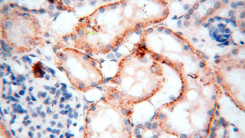 Immunohistochemical of paraffin-embedded human kidney using Catalog No:111545(HSD17B11 antibody) at dilution of 1:100 (under 40x lens)
