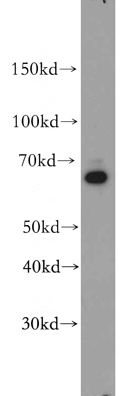 HEK-293 cells were subjected to SDS PAGE followed by western blot with Catalog No:115313(SLC22A15 antibody) at dilution of 1:500