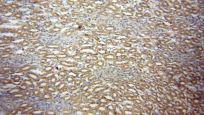Immunohistochemical of paraffin-embedded human kidney using Catalog No:117143(SH3GLB1 antibody) at dilution of 1:100 (under 10x lens)
