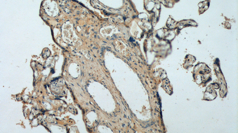 Immunohistochemistry of paraffin-embedded human placenta tissue slide using Catalog No:110655(FBN2-Specific Antibody) at dilution of 1:100 (under 10x lens).