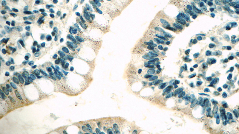Immunohistochemistry of paraffin-embedded human small intestine tissue slide using Catalog No:112541(MC3R Antibody) at dilution of 1:50 (under 40x lens)
