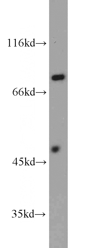 mouse heart tissue were subjected to SDS PAGE followed by western blot with Catalog No:113773(PFKP antibody) at dilution of 1:1500