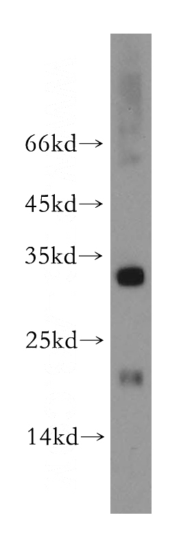 mouse liver tissue were subjected to SDS PAGE followed by western blot with Catalog No:109483(COX11 antibody) at dilution of 1:3000