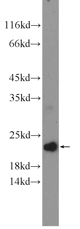 mouse testis tissue were subjected to SDS PAGE followed by western blot with Catalog No:109420(CNBP Antibody) at dilution of 1:300
