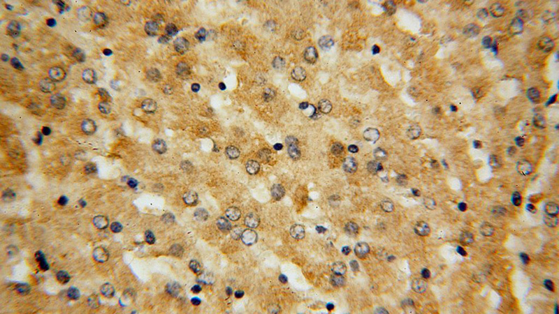 Immunohistochemical of paraffin-embedded human liver using Catalog No:110959(GGCX antibody) at dilution of 1:100 (under 40x lens)