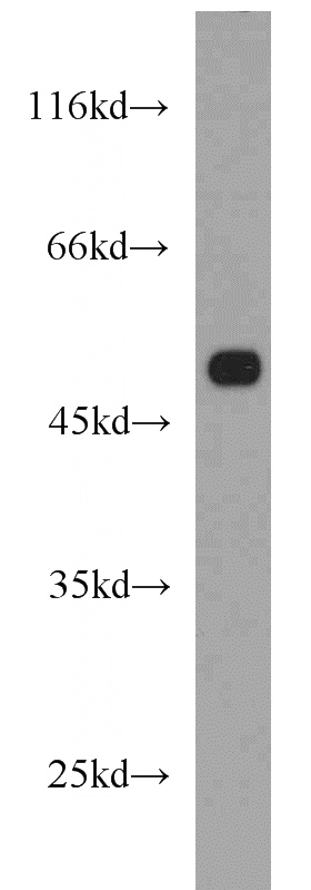 HeLa cells were subjected to SDS PAGE followed by western blot with Catalog No:108818(CALCocO2 antibody) at dilution of 1:1000