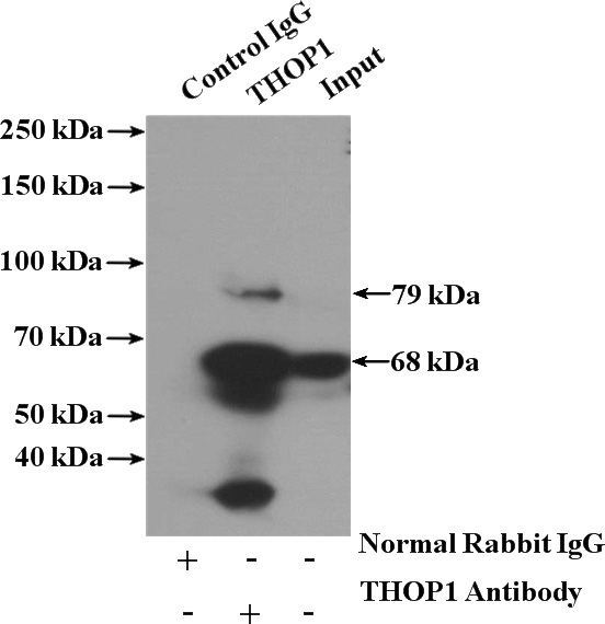 IP Result of anti-THOP1 (IP:Catalog No:116051, 4ug; Detection:Catalog No:116051 1:500) with human placenta tissue lysate 1520ug.