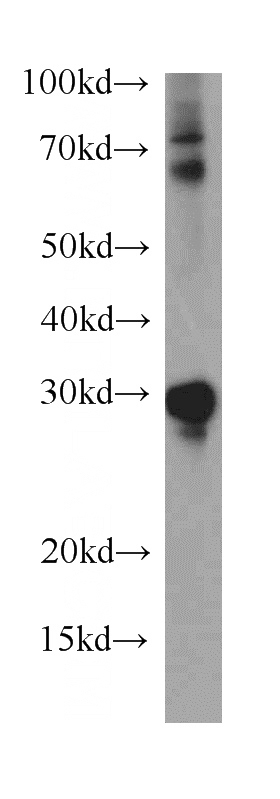 HEK-293 cells were subjected to SDS PAGE followed by western blot with Catalog No:111480(HMGB2 antibody) at dilution of 1:500