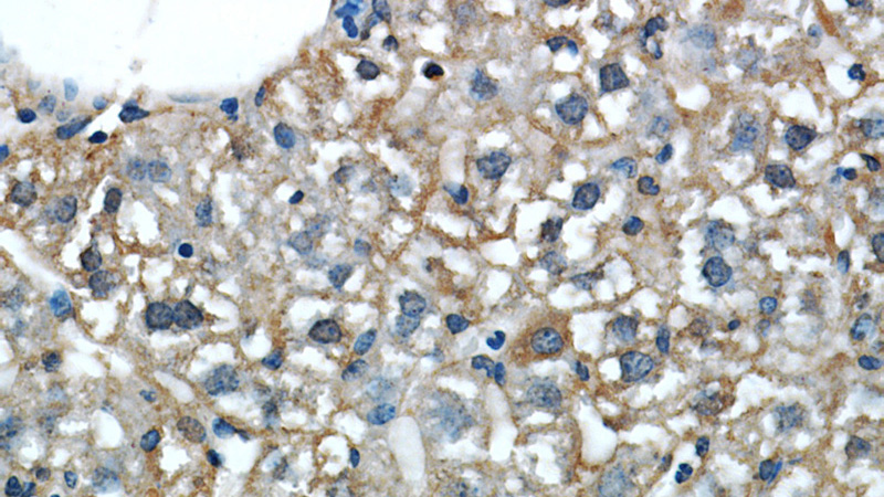 Immunohistochemical of paraffin-embedded mouse liver using Catalog No:112396(L-VocC antibody) at dilution of 1:50 (under 40x lens)