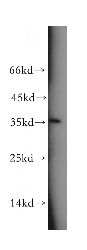 human brain tissue were subjected to SDS PAGE followed by western blot with Catalog No:116442(TSPAN11 antibody) at dilution of 1:800