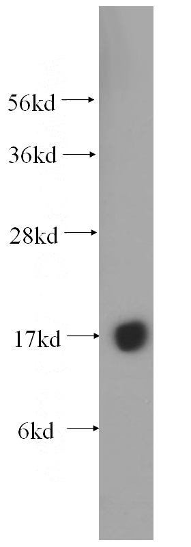 HL-60 cells were subjected to SDS PAGE followed by western blot with Catalog No:114043(POLR2H antibody) at dilution of 1:400