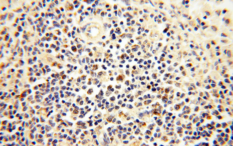 Immunohistochemical of paraffin-embedded human spleen using Catalog No:112842(MRPS15 antibody) at dilution of 1:100 (under 40x lens)