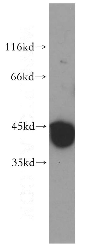 mouse brain tissue were subjected to SDS PAGE followed by western blot with Catalog No:114240(PRPSAP2 antibody) at dilution of 1:1000