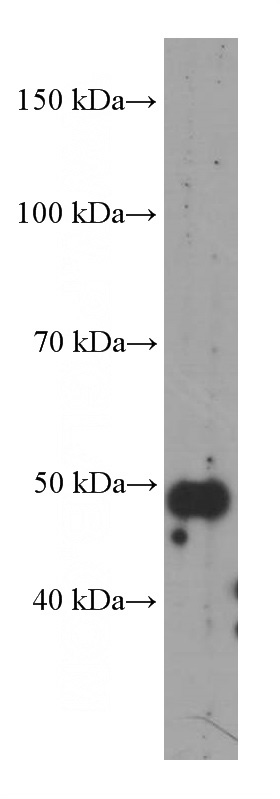 MCF-7 cells were subjected to SDS PAGE followed by western blot with Catalog No:107644(TRIM44 Antibody) at dilution of 1:1000