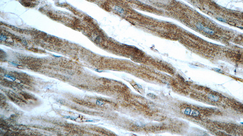 Immunohistochemistry of paraffin-embedded human heart tissue slide using Catalog No:107892(ADRB2 Antibody) at dilution of 1:50 (under 40x lens)