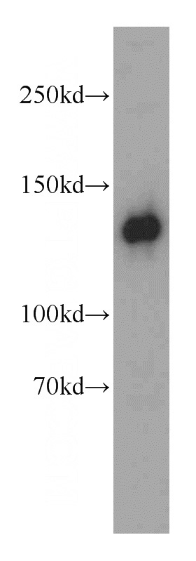 HEK-293 cells were subjected to SDS PAGE followed by western blot with Catalog No:114445(RAB3GAP1 antibody) at dilution of 1:500