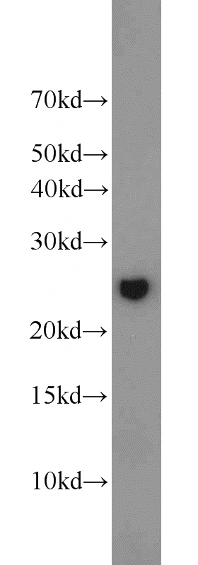Jurkat cells were subjected to SDS PAGE followed by western blot with Catalog No:111049(GOSR2 antibody) at dilution of 1:1000