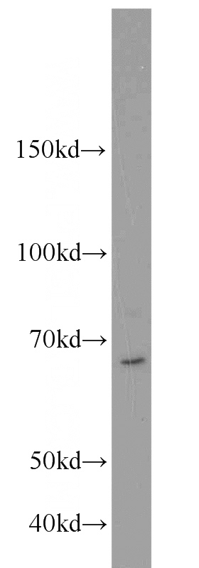 BxPC-3 cells were subjected to SDS PAGE followed by western blot with Catalog No:116663(UBR2 antibody) at dilution of 1:600