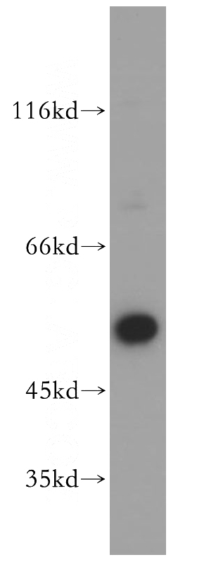 MCF7 cells were subjected to SDS PAGE followed by western blot with Catalog No:117238(PTK6 antibody) at dilution of 1:500