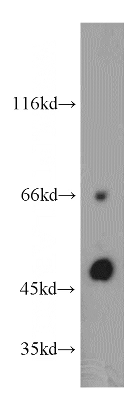 A375 cells were subjected to SDS PAGE followed by western blot with Catalog No:115913(TCN2 antibody) at dilution of 1:100
