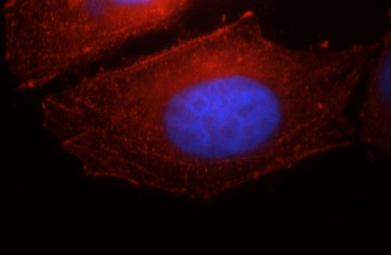 Immunofluorescent analysis of HepG2 cells, using CDH1 antibody Catalog No:110289 at 1:25 dilution and Rhodamine-labeled goat anti-rabbit IgG (red). Blue pseudocolor = DAPI (fluorescent DNA dye).