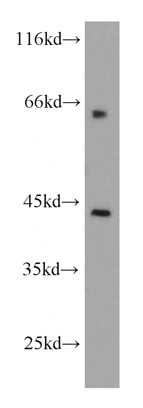 MCF7 cells were subjected to SDS PAGE followed by western blot with Catalog No:108161(ACTR2 antibody) at dilution of 1:500
