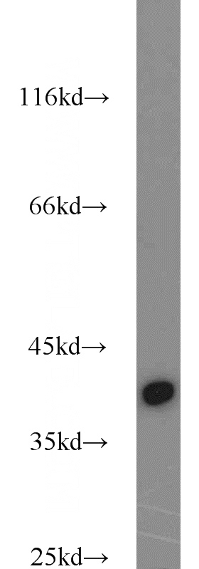 PC-13 cells were subjected to SDS PAGE followed by western blot with Catalog No:116640(URAT1 antibody) at dilution of 1:600