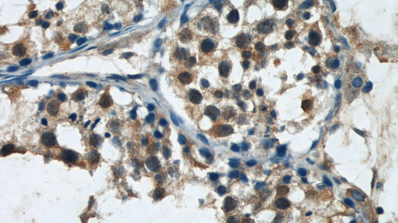 Immunohistochemical of paraffin-embedded human testis using Catalog No:113271(NRAS antibody) at dilution of 1:50 (under 40x lens)