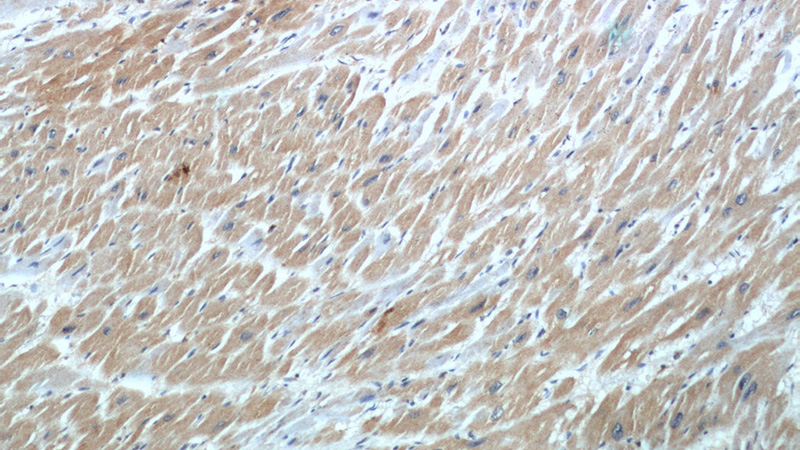 Immunohistochemical of paraffin-embedded human heart using Catalog No:108859(TNNI3 antibody) at dilution of 1:50 (under 10x lens)