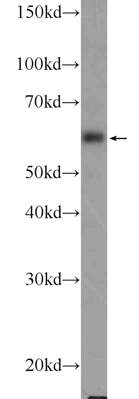 MCF-7 cells were subjected to SDS PAGE followed by western blot with Catalog No:115909(TCHP Antibody) at dilution of 1:600