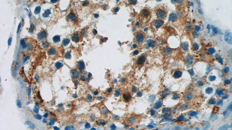 Immunohistochemistry of paraffin-embedded human testis tissue slide using Catalog No:109722(CTDSPL2 Antibody) at dilution of 1:50 (under 40x lens)