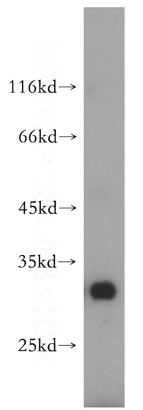 HepG2 cells were subjected to SDS PAGE followed by western blot with Catalog No:114557(RBMX2 antibody) at dilution of 1:500