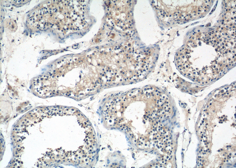Immunohistochemistry of paraffin-embedded human testis tissue slide using Catalog No:108067(ANKRD13B Antibody) at dilution of 1:50 (under 10x lens)