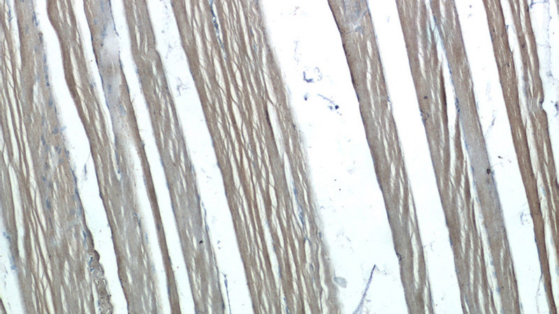 Immunohistochemistry of paraffin-embedded human skeletal muscle tissue slide using Catalog No:110566(FBXW7 Antibody) at dilution of 1:50 (under 10x lens)
