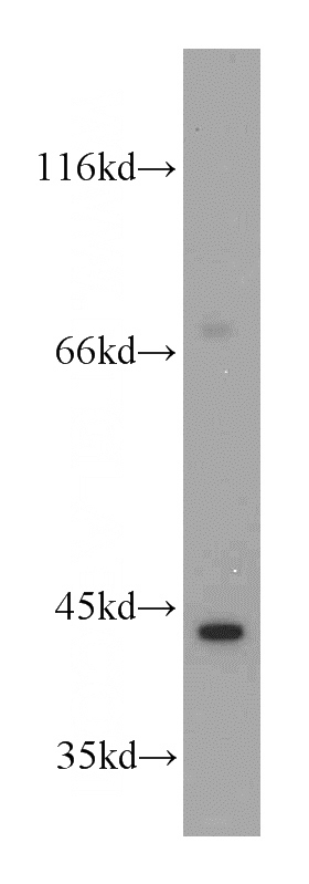 HeLa cells were subjected to SDS PAGE followed by western blot with Catalog No:111807(INPP5A antibody) at dilution of 1:500