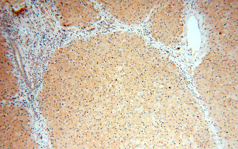 Immunohistochemical of paraffin-embedded human liver using Catalog No:113458(OAS1 antibody) at dilution of 1:100 (under 10x lens)