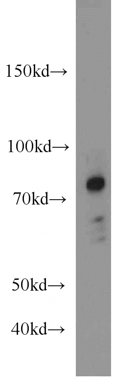 mouse small intestine tissue were subjected to SDS PAGE followed by western blot with Catalog No:108821(CALD1 antibody) at dilution of 1:500