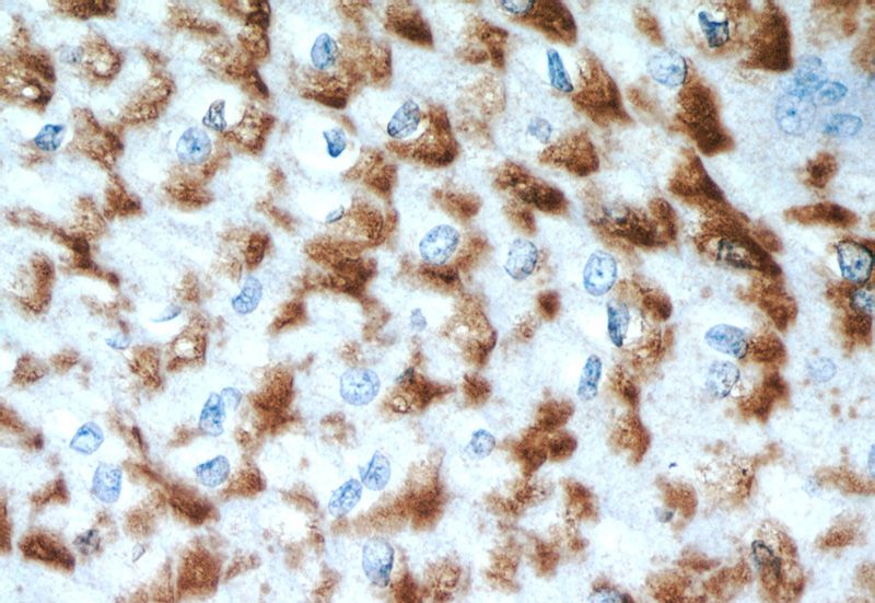 Immunohistochemical of paraffin-embedded human oesophagus using Catalog No:111252(GUF1 antibody) at dilution of 1:50 (under 40x lens)