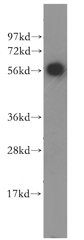 HeLa cells were subjected to SDS PAGE followed by western blot with Catalog No:115291(SEPSECS antibody) at dilution of 1:400