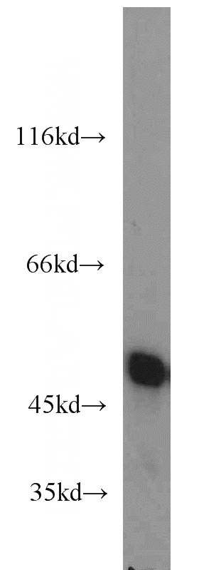 HeLa cells were subjected to SDS PAGE followed by western blot with Catalog No:110252(ENO1 antibody) at dilution of 1:2000