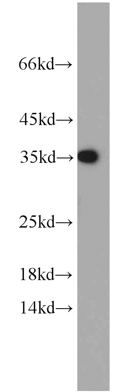 mouse brain tissue were subjected to SDS PAGE followed by western blot with Catalog No:113845(PRKACB antibody) at dilution of 1:500