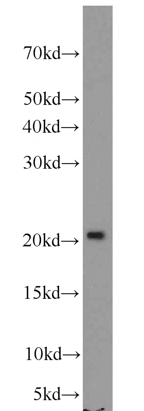 human heart tissue were subjected to SDS PAGE followed by western blot with Catalog No:110632(FGF16-Specific antibody) at dilution of 1:300