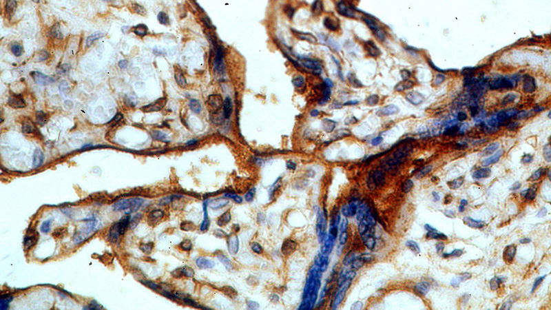 Immunohistochemical of paraffin-embedded human placenta using Catalog No:108993(CCDC94 antibody) at dilution of 1:50 (under 40x lens)